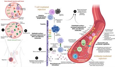 Molecular immune monitoring in kidney transplant rejection: a state-of-the-art review